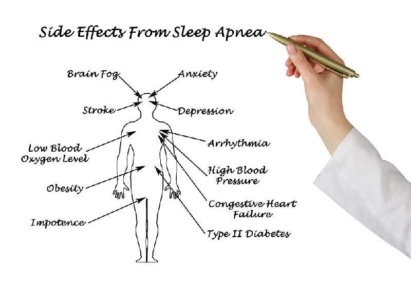 Sleep-Apnea-Treatment-Mesa-AZ