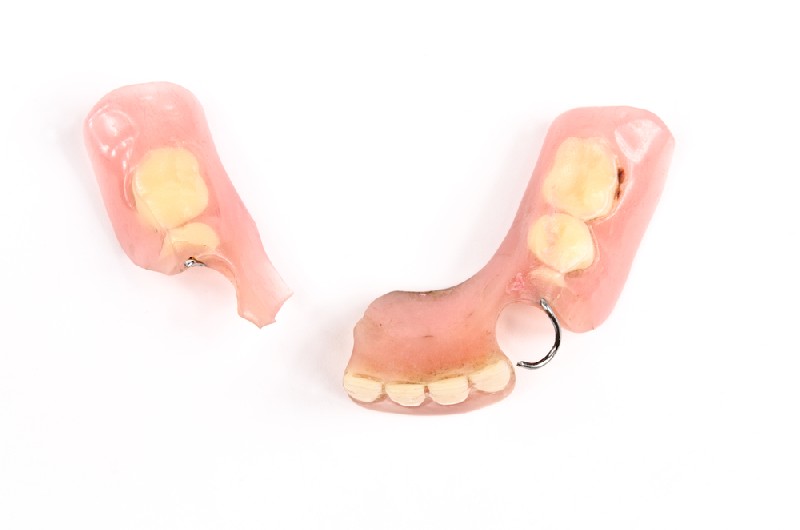 Denture-Repair-Queen-Creek-AZ