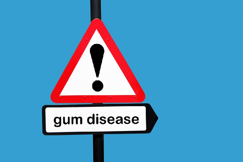 Gum-Disease-Mesa-AZ
