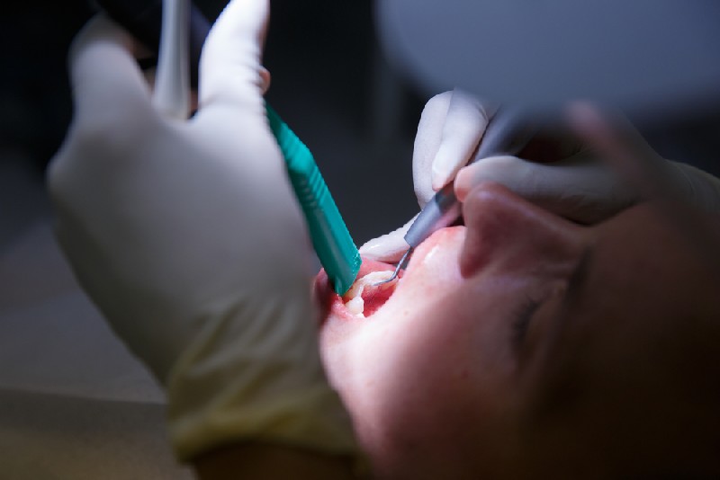 Gum-Disease-Treatment-Mesa-AZ