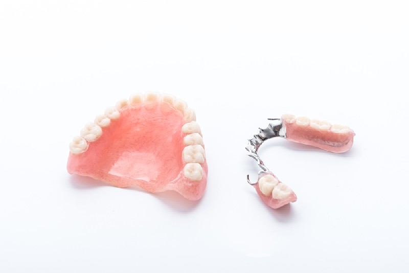 Partial-Dentures-Gilbert-AZ