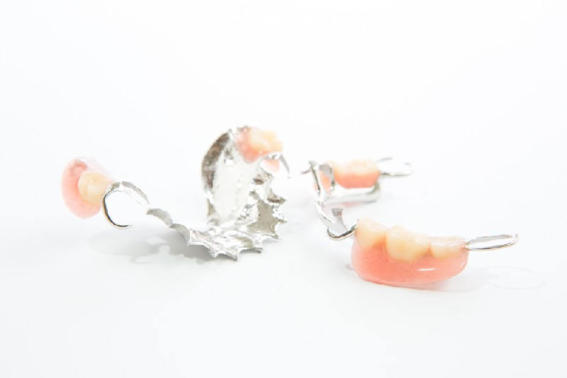 Partial-Dentures-Tempe-AZ