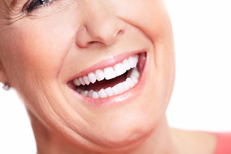 Teeth-Whitening-Mesa-AZ